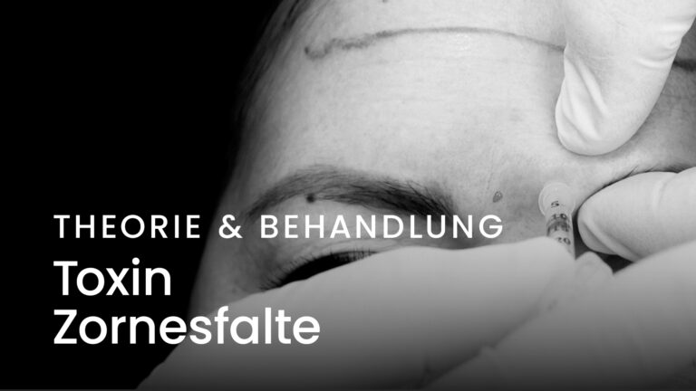 T_ und TR__VP1_Toxin_Zornesfalte Anita