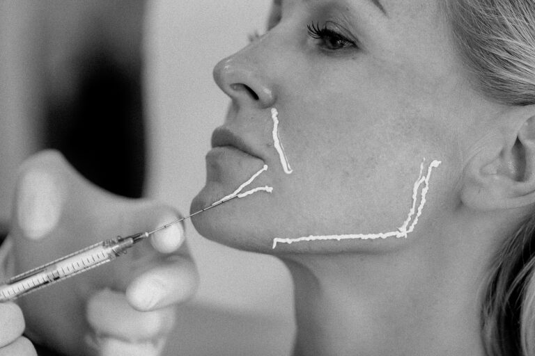 Hybrid Filler & Radiesse Expert